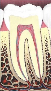 root canal illustration 1