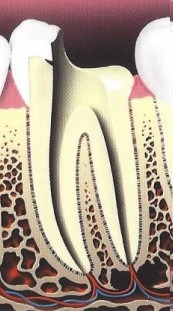 root canal illustration 4